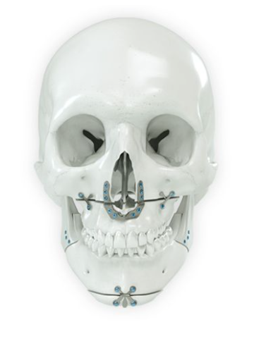 Curso en protocolos para cirugía maxilofacial